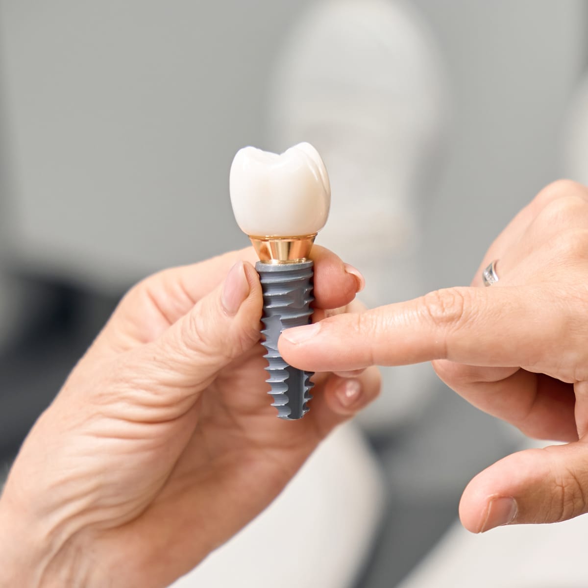 Klinika-Šypsena-dantų-implantai