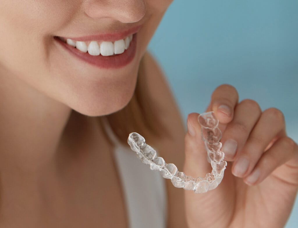 Klinika Sypsena ortodontinis gydymas kapomis