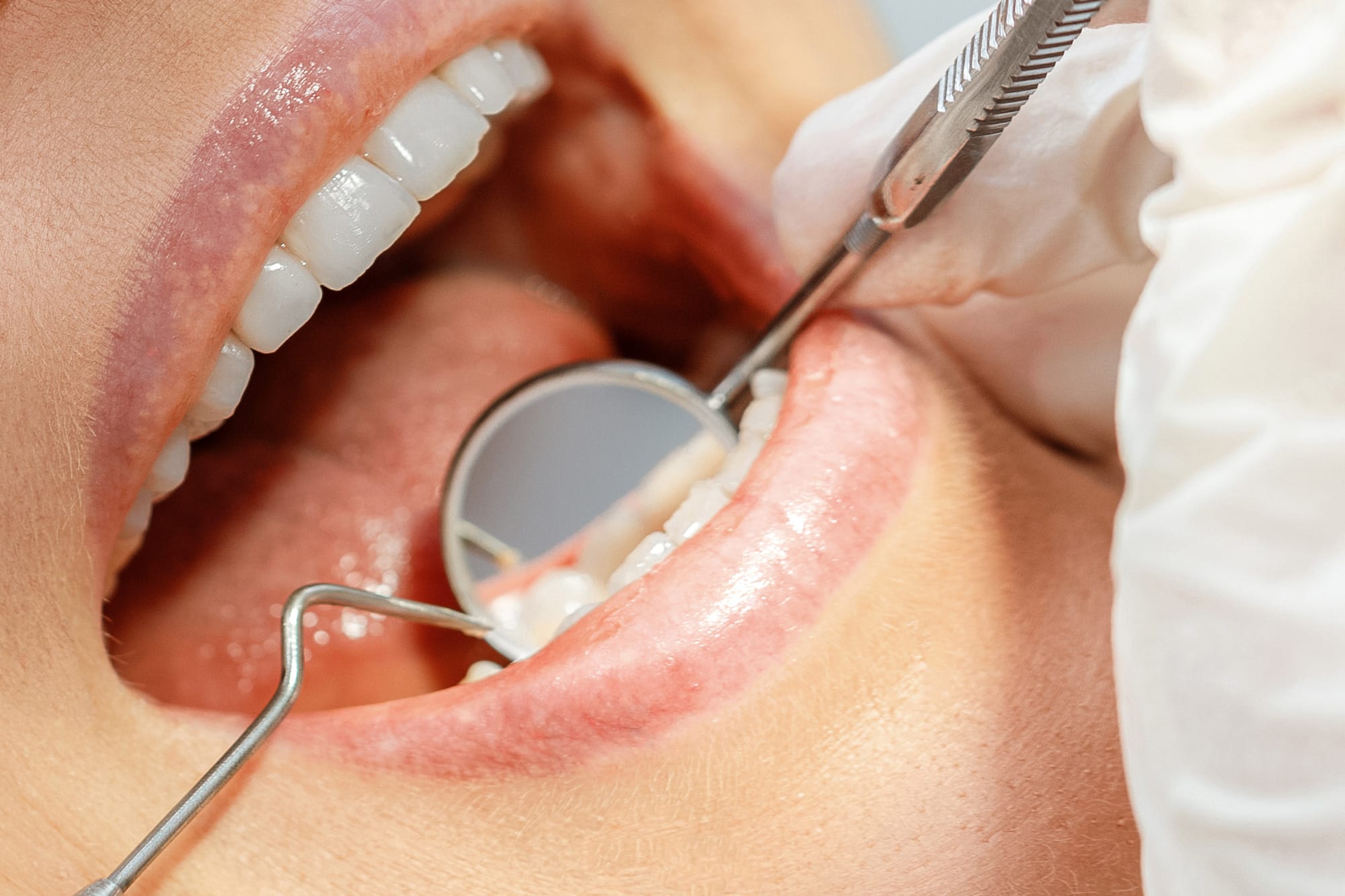 Panevėžio „Affidea“ pacientams 1 odontologijos-klinika-sypsena-affidea-pacientams-panevezys