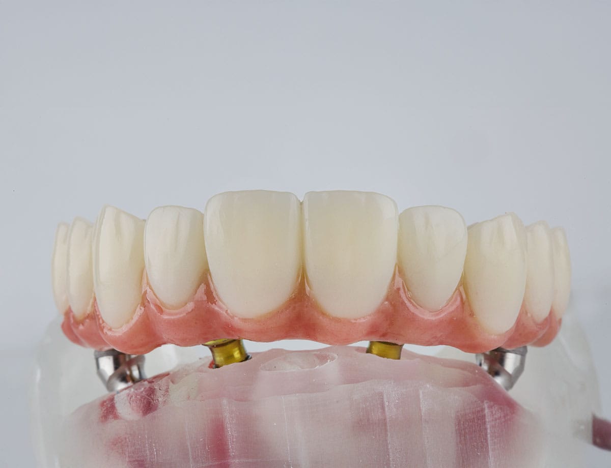 paslauga Klinika Sypsena all on 4