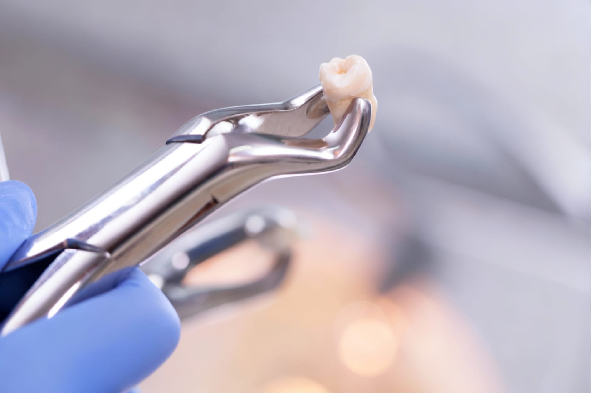 sypsenaok klinika dantu salinimas 3