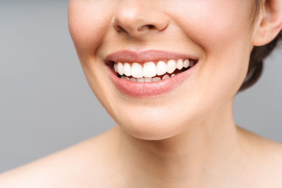 sypsenaok klinika laminates 2