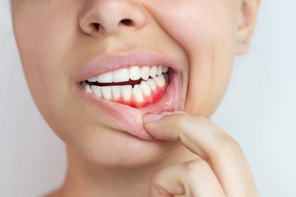 sypsenaok klinika periodontologija 1