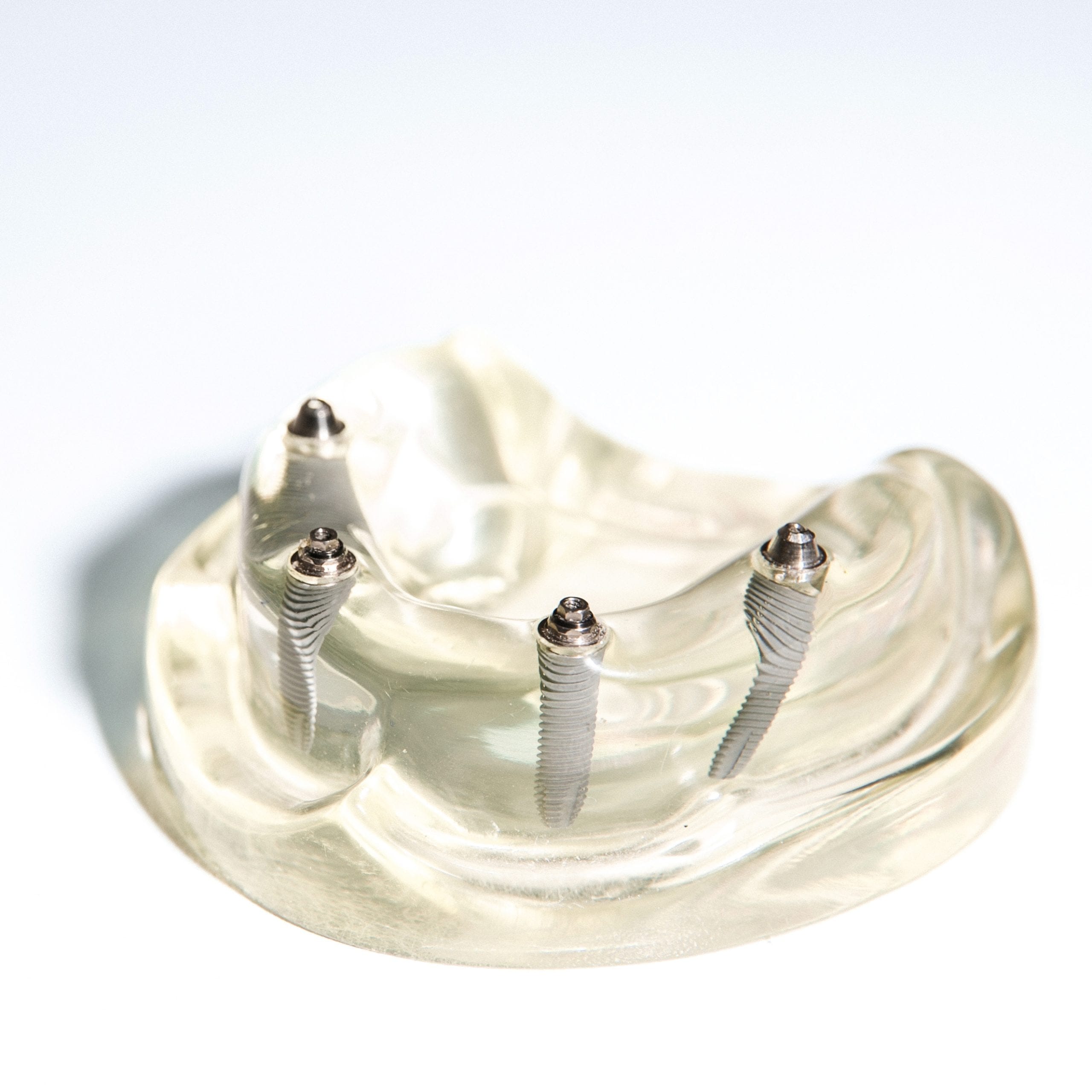 sypsenaok klinika viso lanko atstatymas 2