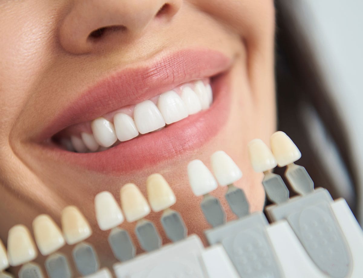 paslauga Klinika Sypsena dantu balinimas