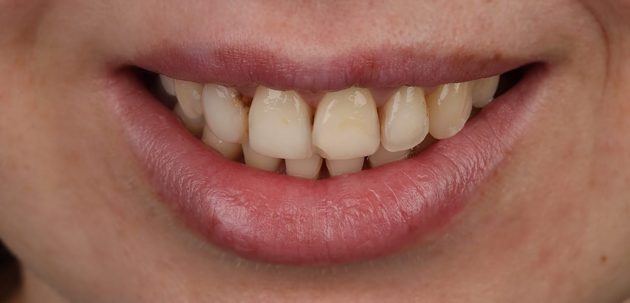 Pagrindinis 2 sypsenaok main pries