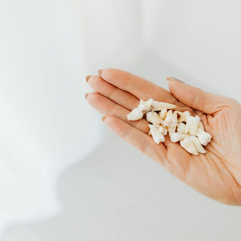 sypsenaok klinika dantu salinimas