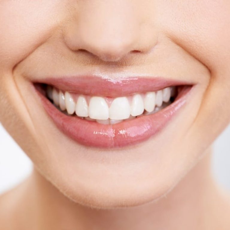 sypsenaok klinika estetinis plombavimas 5